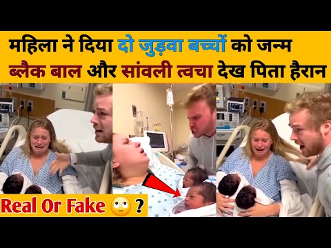 Viral Couple Twins Baby black hair 😱 | महिला ने दिया दो जुड़वा बच्चों को जन्म  देख पिता हैरान | Fact