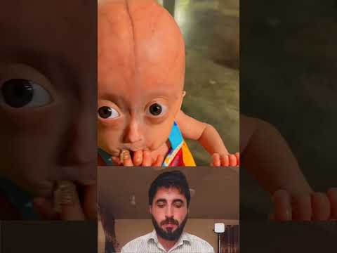 Pretty Little Baby 💖❤️ | Huge Respect | God Bless You | #eliseeloa #cutekids #respect #shorts #viral