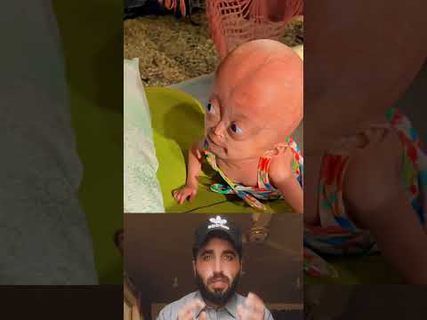 Pretty Little Baby 💖❤️ | Huge Respect | God Bless You | #eliseeloa #cutekids #respect #shorts #viral