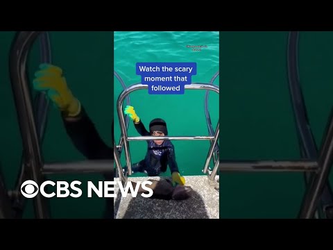 A shark bit an 8-year-old boy during a fishing trip in Australia, leaving a minor bite mark #shorts