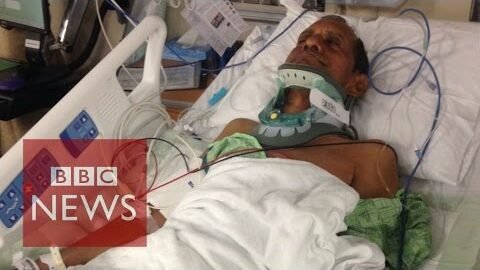 Indian injured by US police speaks out – BBC News