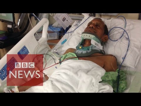 Indian injured by US police speaks out – BBC News