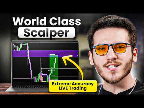 Trading LIVE with One of the World’s BEST Scalpers (PERFECT Sniper Entries)
