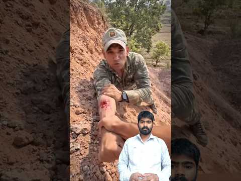 जॉम्बीज खा गए हैं हाथों को #army #shortsfeed #ख़बर1इंडिया #indianarmy