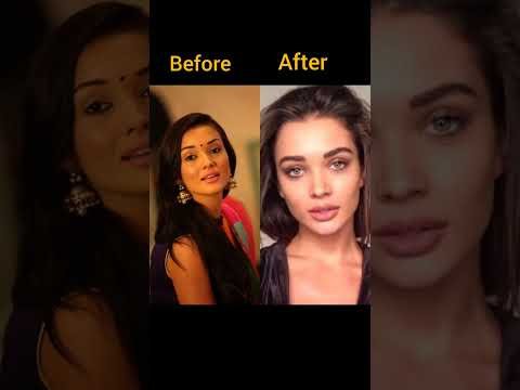 Amy Jackson plastic surgery looks #viral #youtubeshorts#shorts  #bollywood #actress#amyjackson