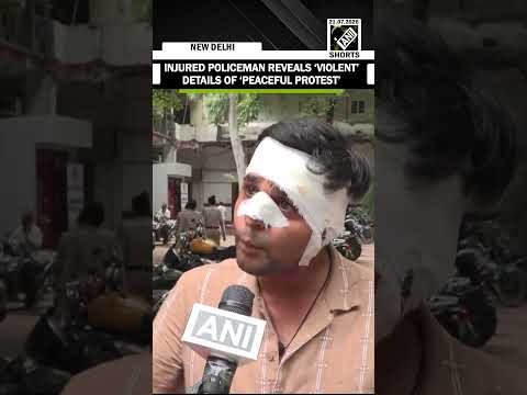 ‘Sharpened tiles pelted’, Injured policeman busts ‘peaceful protest’ myth| Jantar-Mantar protest|CJP