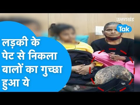 Dehradun के डॉक्टरों ने ऑपरेशन कर निकाला लड़की के पेट से बालों का गुच्छा