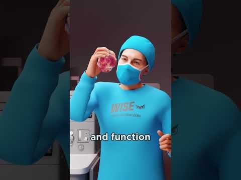 Heart Transplant Surgery (Explained)